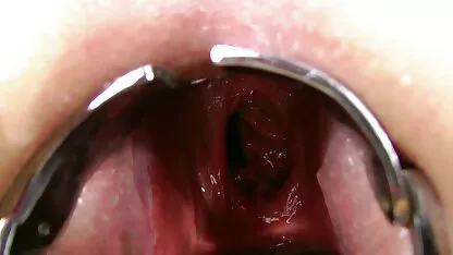 Prolapse Ρωσικά